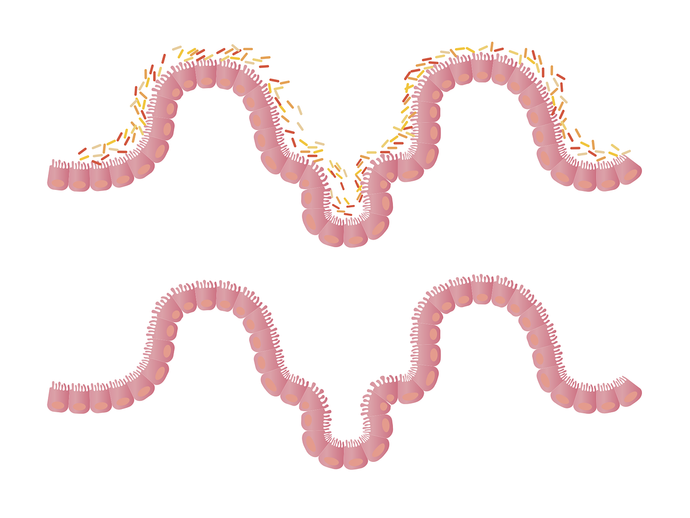 How gut bacteria connect to Parkinson’s disease